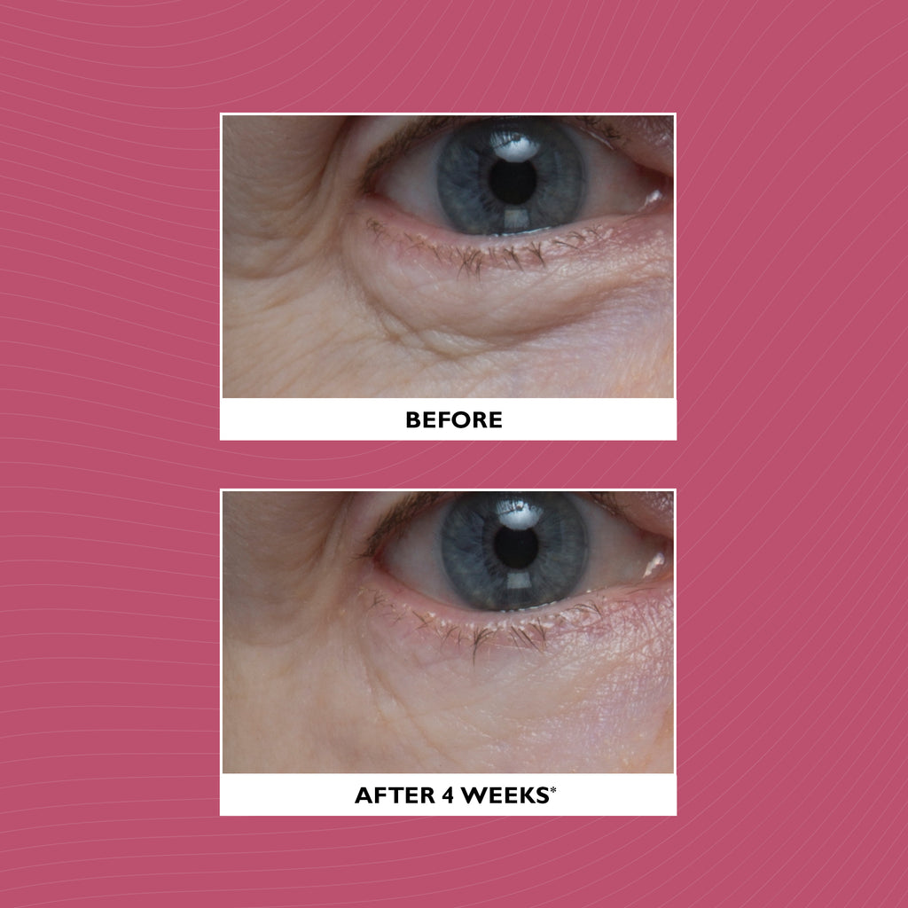 Peter Thomas Roth - Vital-E Antioxidant Recovery Eye Cream 15ml